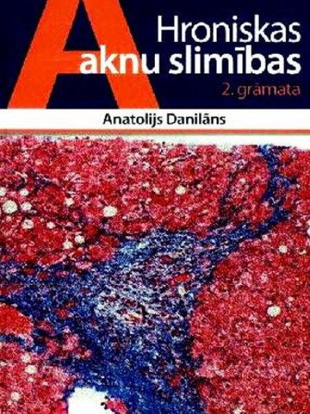 Hroniskas aknu slimības. 2  grāmata