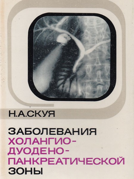 Заболевания холангио-дуодено-панкреатической зоны