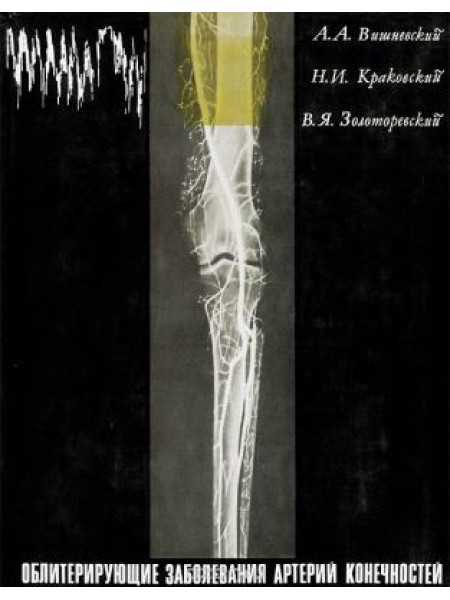 Облитерирующие заболевания артерий конечностей
