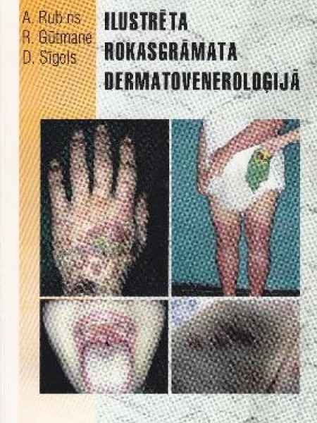 Ilustrēta rokasgrāmata dermatoveneroloģijā
