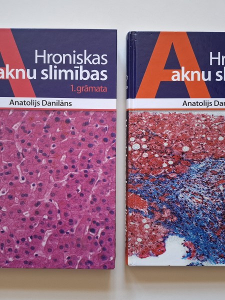 Hroniskas aknu slimības 1. un 2. Grāmata